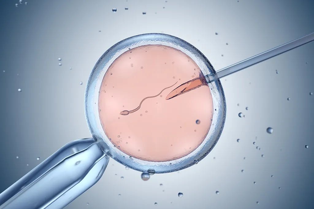 Apa itu Intracytoplasmic Sperm Injection (ICSI)?