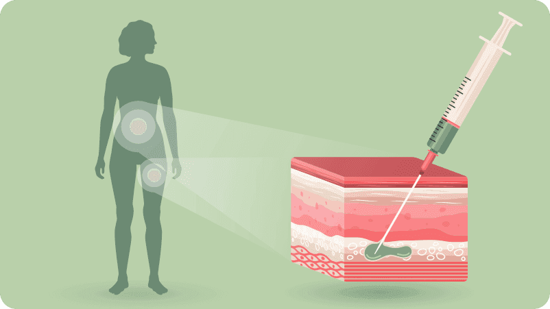 Apa yang Diharapkan Selama Perawatan Fertilitas